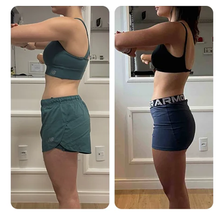 Resultado real de emagrecimento com acompanhamento nutricional